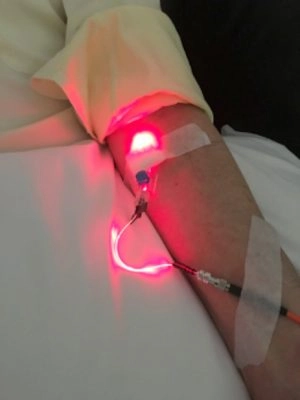 Low-Level Laser Therapy in Denver, CO at Grossman Wellness Center