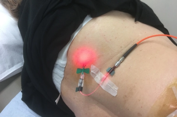 Low-Level Laser Therapy in Denver, CO at Grossman Wellness Center